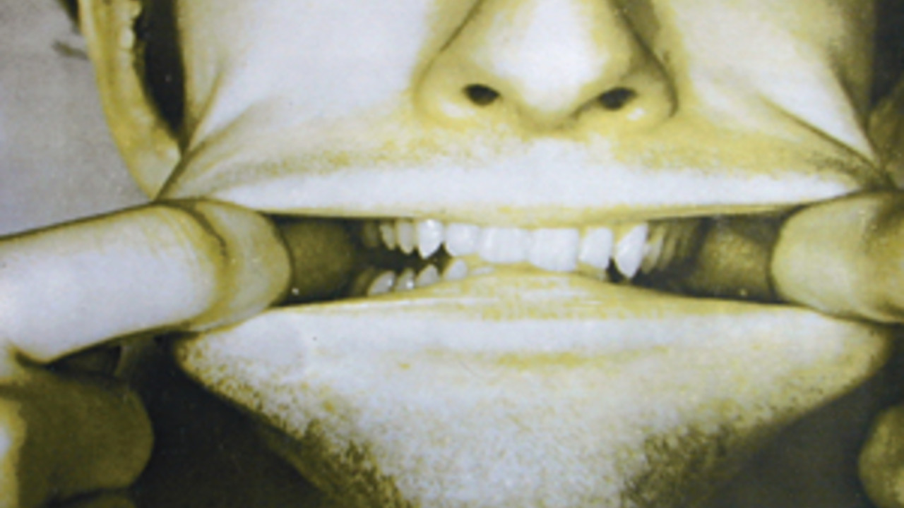 © Bruce Nauman: Studies for Hologram, 1970